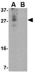 Anti-CDNF antibody used in Western Blot (WB). GTX85431