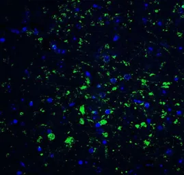 Anti-CDNF antibody used in IHC (Paraffin sections) (IHC-P). GTX85432