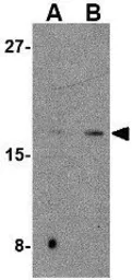 Anti-CDNF antibody used in Western Blot (WB). GTX85432
