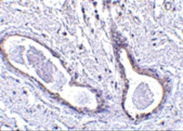 Anti-CCDC98 antibody used in IHC (Paraffin sections) (IHC-P). GTX85433