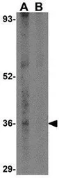 Anti-CCDC98 antibody used in Western Blot (WB). GTX85433