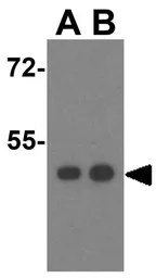 Anti-STEAP3 antibody used in Western Blot (WB). GTX85434