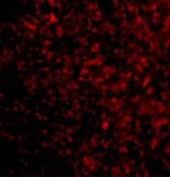 Anti-STEAP3 antibody used in IHC (Paraffin sections) (IHC-P). GTX85434