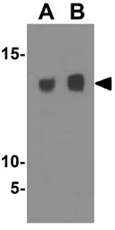 Anti-SLPI antibody used in Western Blot (WB). GTX85436