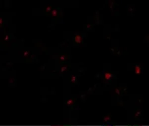 Anti-ORAI3 antibody used in Immunocytochemistry/ Immunofluorescence (ICC/IF). GTX85438