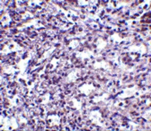 Anti-STIM2 antibody used in IHC (Paraffin sections) (IHC-P). GTX85441