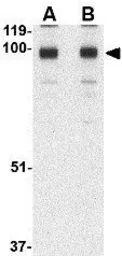 Anti-STIM2 antibody used in Western Blot (WB). GTX85441
