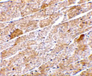 Anti-Neuritin antibody used in IHC (Paraffin sections) (IHC-P). GTX85446