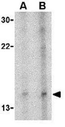 Anti-Neuritin antibody used in Western Blot (WB). GTX85446