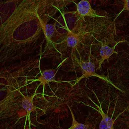 Anti-GAD67 antibody used in Immunocytochemistry/ Immunofluorescence (ICC/IF). GTX85453