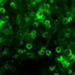 Anti-Netrin 1 antibody used in Immunohistochemistry (IHC). GTX85458