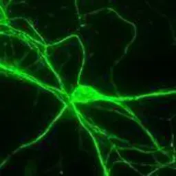 Anti-NF-H antibody used in Immunocytochemistry/ Immunofluorescence (ICC/IF). GTX85459