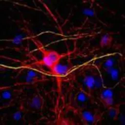 Anti-NF-L antibody used in Immunocytochemistry/ Immunofluorescence (ICC/IF). GTX85460