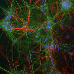 Anti-NF-M antibody used in Immunocytochemistry/ Immunofluorescence (ICC/IF). GTX85461