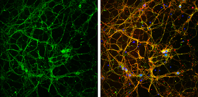 Anti-NF-M antibody used in Immunocytochemistry/ Immunofluorescence (ICC/IF). GTX85461