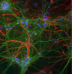 Anti-NF-M antibody used in Immunocytochemistry/ Immunofluorescence (ICC/IF). GTX85461