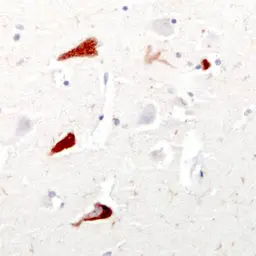Anti-Tau antibody used in IHC (Paraffin sections) (IHC-P). GTX85468