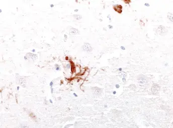 Anti-Tau antibody used in IHC (Paraffin sections) (IHC-P). GTX85468