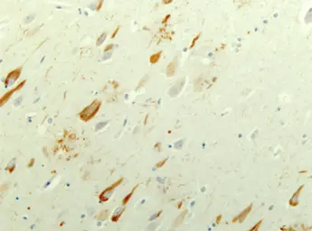 Anti-Tau antibody used in IHC (Paraffin sections) (IHC-P). GTX85468