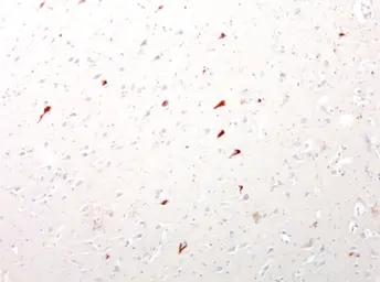 Anti-Tau antibody used in IHC (Paraffin sections) (IHC-P). GTX85468