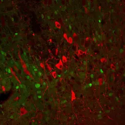 Anti-Tyrosine Hydroxylase antibody used in IHC (Paraffin sections) (IHC-P). GTX85470