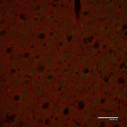 Anti-Tyrosine Hydroxylase antibody used in IHC (Paraffin sections) (IHC-P). GTX85470