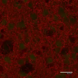 Anti-Tyrosine Hydroxylase antibody used in IHC (Paraffin sections) (IHC-P). GTX85470