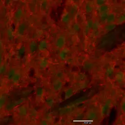 Anti-Tyrosine Hydroxylase antibody used in IHC (Paraffin sections) (IHC-P). GTX85470