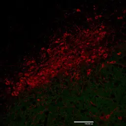 Anti-Tyrosine Hydroxylase antibody used in IHC (Paraffin sections) (IHC-P). GTX85470