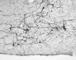 Anti-Tyrosine Hydroxylase antibody used in Immunohistochemistry (IHC). GTX85470