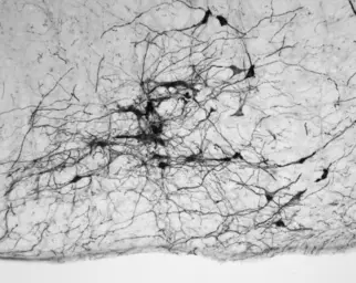 Anti-Tyrosine Hydroxylase antibody used in Immunohistochemistry (IHC). GTX85470