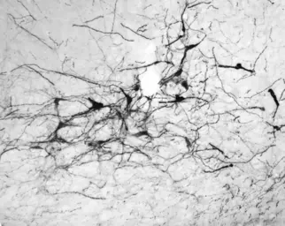 Anti-Tyrosine Hydroxylase antibody used in Immunohistochemistry (IHC). GTX85470