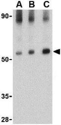Anti-VISA antibody used in Western Blot (WB). GTX85480