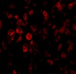 Anti-SCO2 antibody used in IHC (Paraffin sections) (IHC-P). GTX85482