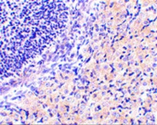 Anti-RPA Interacting Protein antibody used in IHC (Paraffin sections) (IHC-P). GTX85486