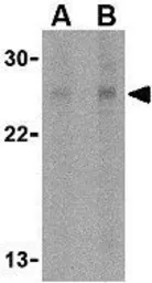 Anti-RPA Interacting Protein antibody used in Western Blot (WB). GTX85486