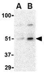 Anti-IRF7 antibody used in Western Blot (WB). GTX85489