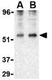 Anti-TIP47 antibody used in Western Blot (WB). GTX85492