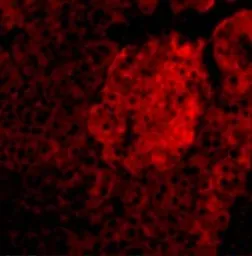 Anti-IL23 antibody used in IHC (Paraffin sections) (IHC-P). GTX85495