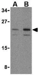 Anti-IL23 antibody used in Western Blot (WB). GTX85495
