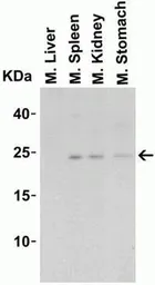 Anti-IL23 antibody used in Western Blot (WB). GTX85495