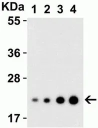 Anti-IL23 antibody used in Western Blot (WB). GTX85495