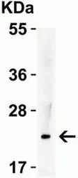 Anti-IL23 antibody used in Western Blot (WB). GTX85496