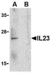 Anti-IL23 antibody used in Western Blot (WB). GTX85496