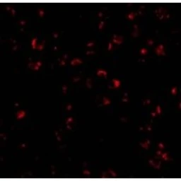 Anti-IL23 antibody used in Immunocytochemistry/ Immunofluorescence (ICC/IF). GTX85496