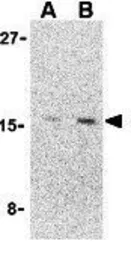Anti-Precerebellin antibody used in Western Blot (WB). GTX85500