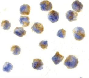 Anti-Precerebellin antibody used in Immunocytochemistry/ Immunofluorescence (ICC/IF). GTX85500