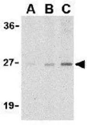 Anti-CTRP7 antibody used in Western Blot (WB). GTX85501