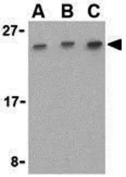 Anti-CTRP7 antibody used in Western Blot (WB). GTX85502