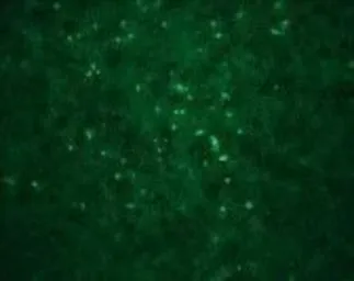 Anti-West Nile virus Capsid protein antibody used in Immunocytochemistry/ Immunofluorescence (ICC/IF). GTX85509